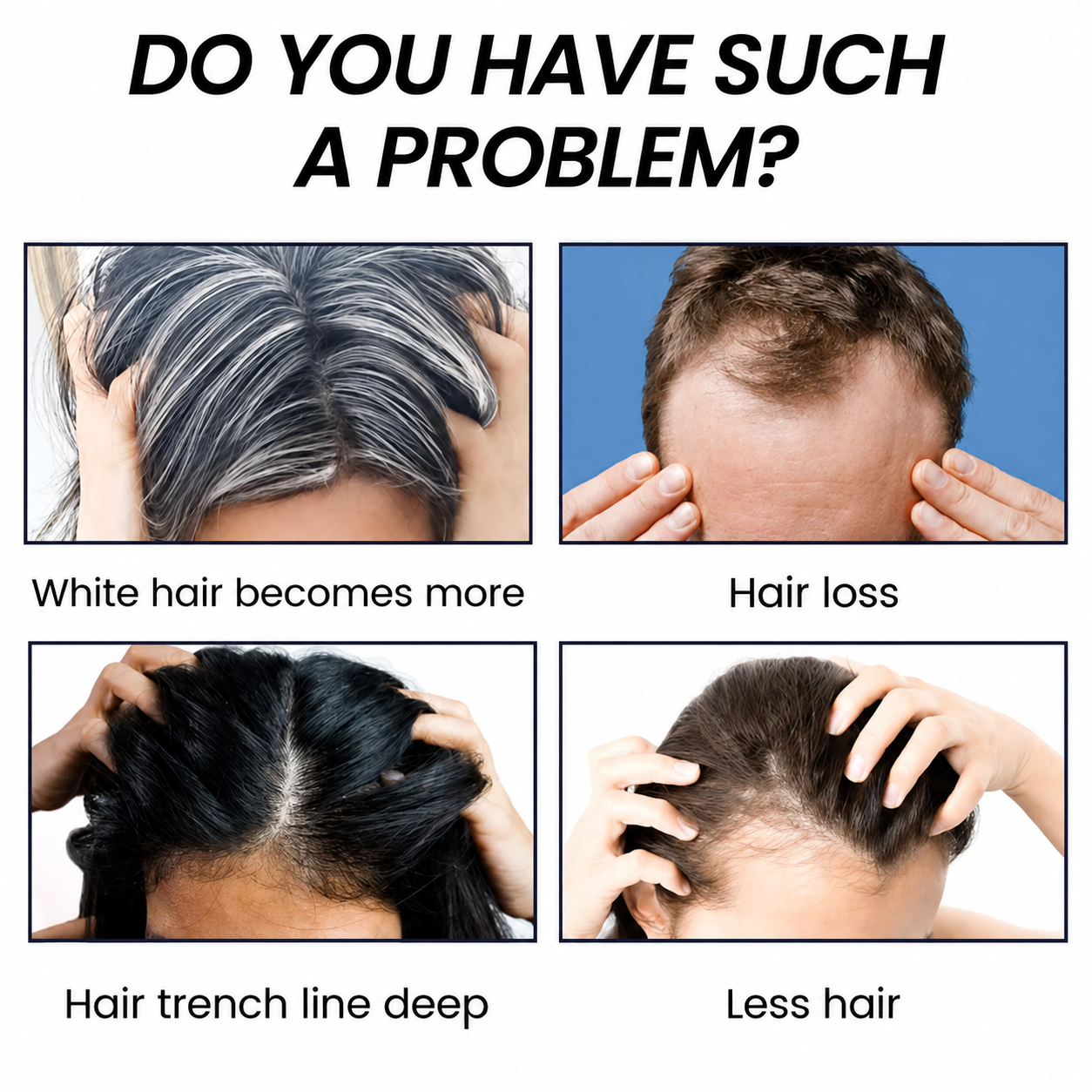 EELHOE Hair regrowth serum