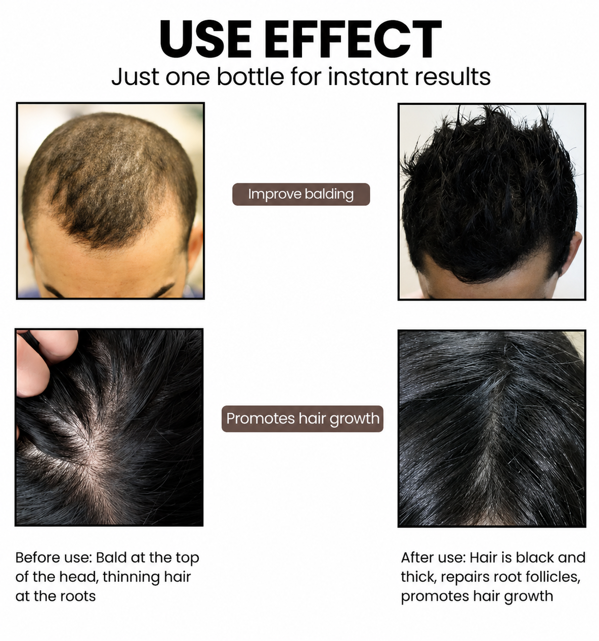 EELHOE Hair regrowth serum